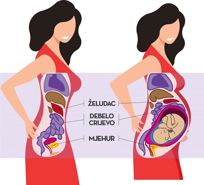 Tijekom trudnoće raste plod i povećava se maternica, a s njom i pritisak na debelo crijevo - Kivilaks